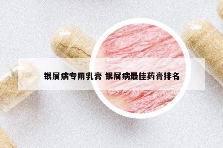 銀屑病專用乳膏 銀屑病最佳藥膏排名