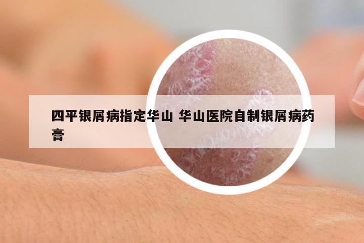 四平銀屑病指定華山 華山醫(yī)院自制銀屑病藥膏
