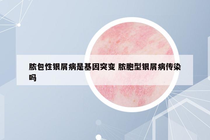 膿包性銀屑病是基因突變 膿胞型銀屑病傳染嗎