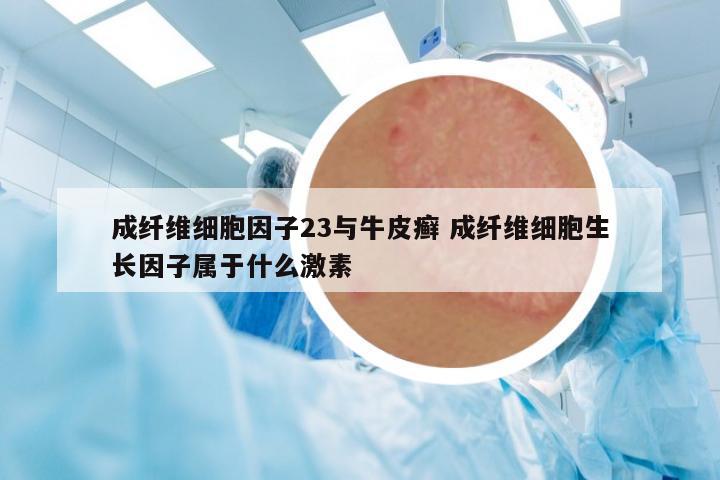 成纖維細胞因子23與牛皮癬 成纖維細胞生長因子屬于什么激素