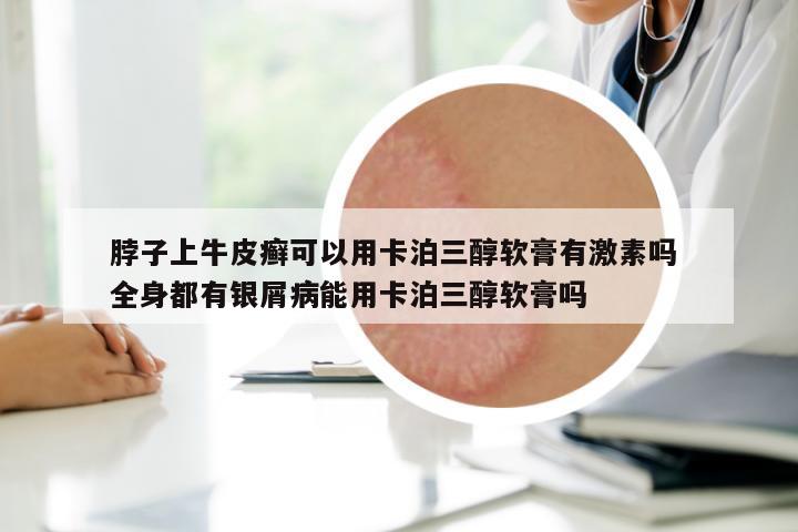 脖子上牛皮癬可以用卡泊三醇軟膏有激素嗎 全身都有銀屑病能用卡泊三醇軟膏嗎