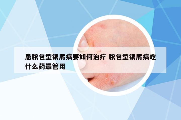 患膿包型銀屑病要如何治療 膿包型銀屑病吃什么藥最管用