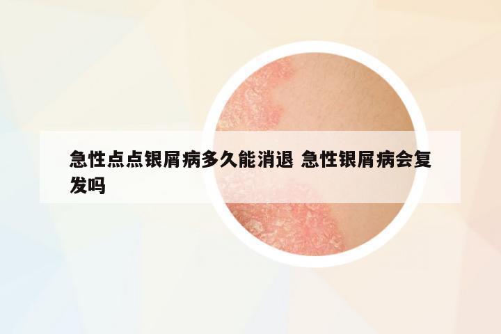 急性點(diǎn)點(diǎn)銀屑病多久能消退 急性銀屑病會(huì)復(fù)發(fā)嗎