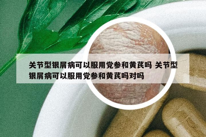 關節(jié)型銀屑病可以服用黨參和黃芪嗎 關節(jié)型銀屑病可以服用黨參和黃芪嗎對嗎