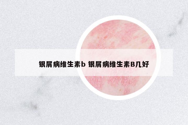 銀屑病維生素b 銀屑病維生素B幾好