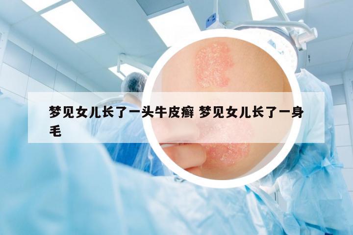 夢見女兒長了一頭牛皮癬 夢見女兒長了一身毛