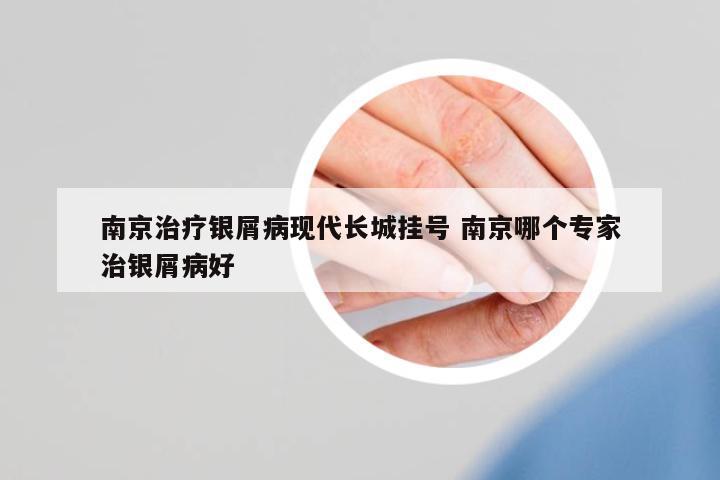 南京治療銀屑病現(xiàn)代長城掛號 南京哪個(gè)專家治銀屑病好