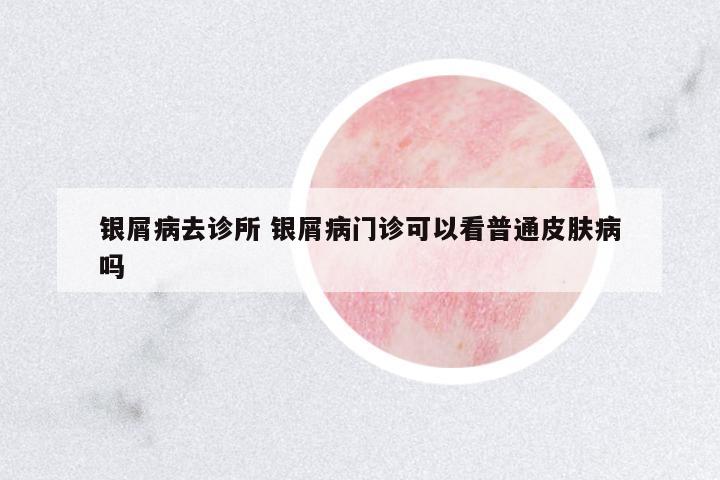 銀屑病去診所 銀屑病門診可以看普通皮膚病嗎