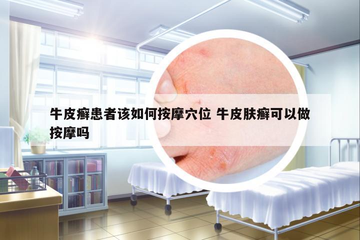 牛皮癬患者該如何按摩穴位 牛皮膚癬可以做按摩嗎