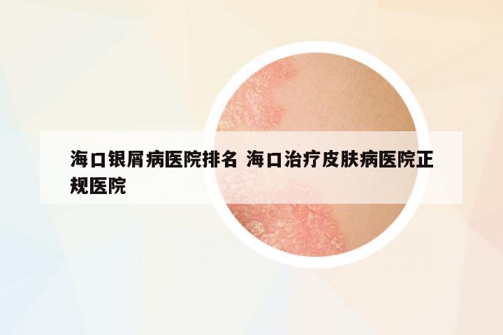 ??阢y屑病醫(yī)院排名 海口治療皮膚病醫(yī)院正規(guī)醫(yī)院