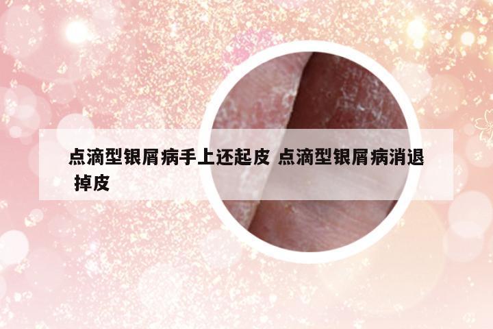 點(diǎn)滴型銀屑病手上還起皮 點(diǎn)滴型銀屑病消退 掉皮