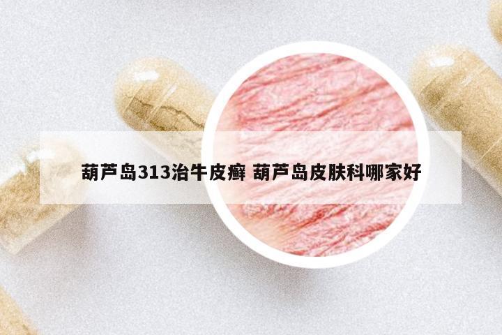 葫蘆島313治牛皮癬 葫蘆島皮膚科哪家好