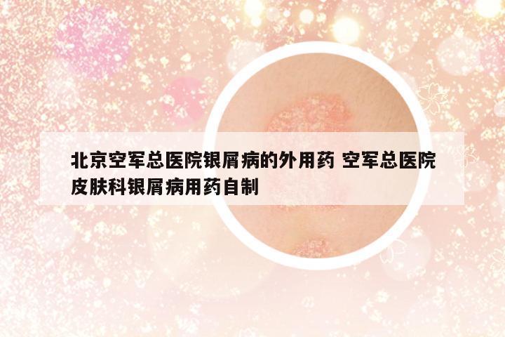 北京空軍總醫(yī)院銀屑病的外用藥 空軍總醫(yī)院皮膚科銀屑病用藥自制