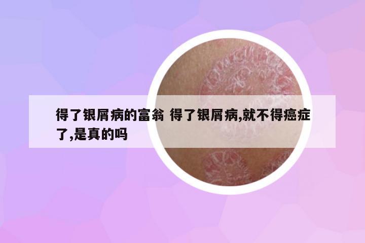 得了銀屑病的富翁 得了銀屑病,就不得癌癥了,是真的嗎