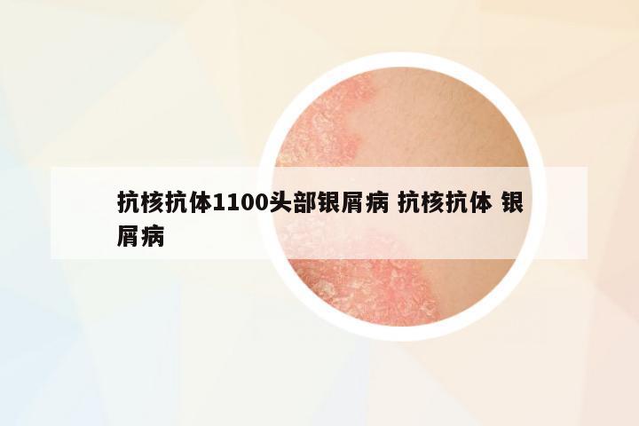 抗核抗體1100頭部銀屑病 抗核抗體 銀屑病