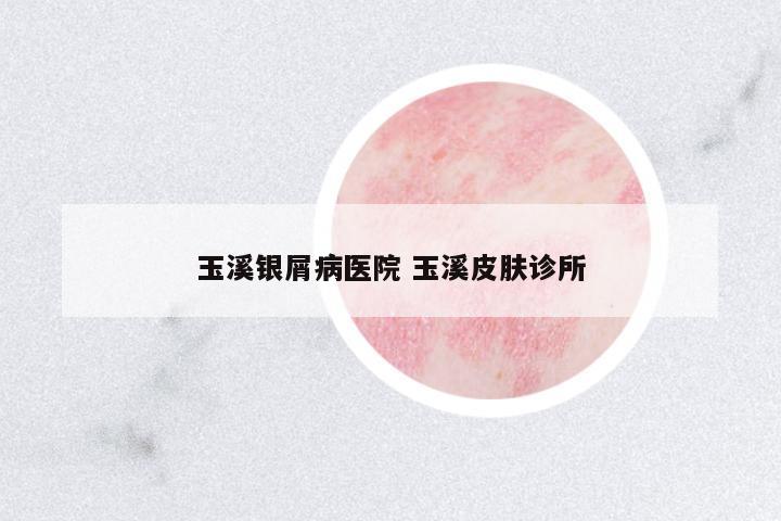玉溪銀屑病醫(yī)院 玉溪皮膚診所