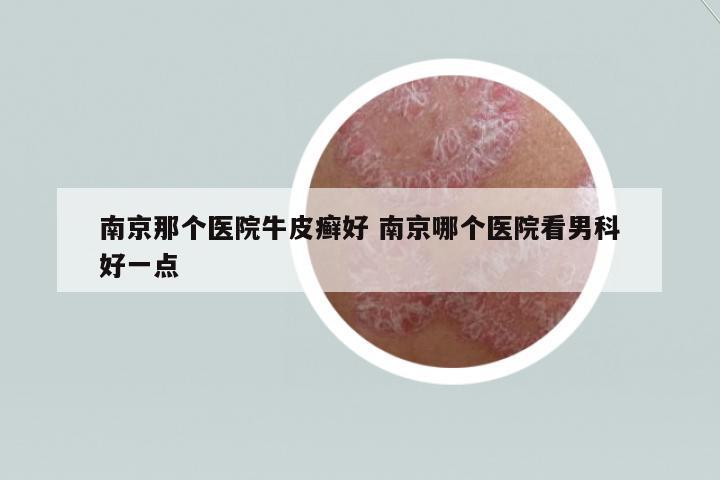 南京那個醫(yī)院牛皮癬好 南京哪個醫(yī)院看男科好一點