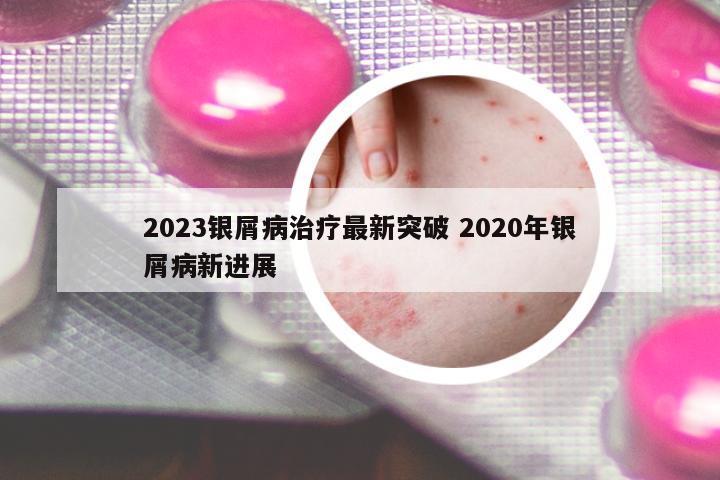 2023銀屑病治療最新突破 2020年銀屑病新進展