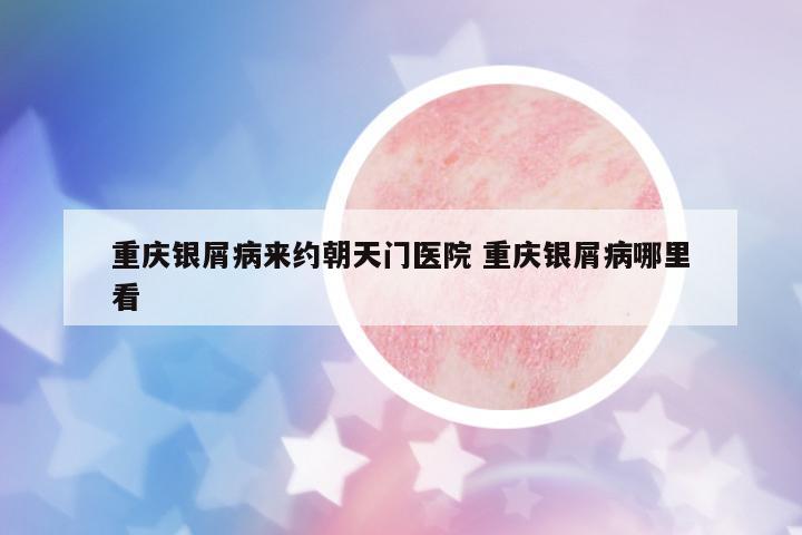 重慶銀屑病來約朝天門醫(yī)院 重慶銀屑病哪里看