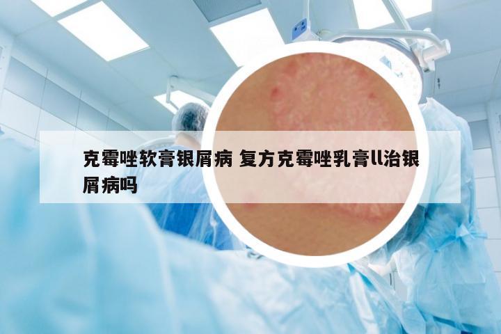 克霉唑軟膏銀屑病 復(fù)方克霉唑乳膏l(xiāng)l治銀屑病嗎