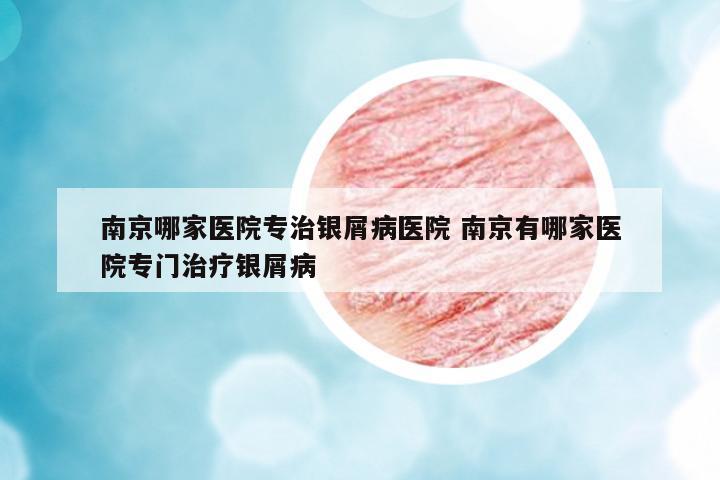南京哪家醫(yī)院專治銀屑病醫(yī)院 南京有哪家醫(yī)院專門治療銀屑病