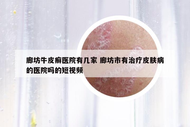 廊坊牛皮癬醫(yī)院有幾家 廊坊市有治療皮膚病的醫(yī)院嗎的短視頻
