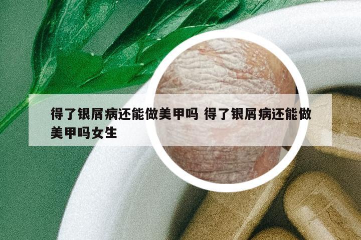 得了銀屑病還能做美甲嗎 得了銀屑病還能做美甲嗎女生