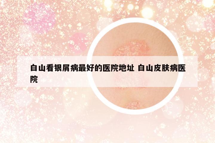 白山看銀屑病最好的醫(yī)院地址 白山皮膚病醫(yī)院