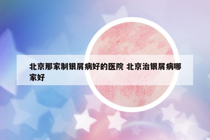 北京那家制銀屑病好的醫(yī)院 北京治銀屑病哪家好