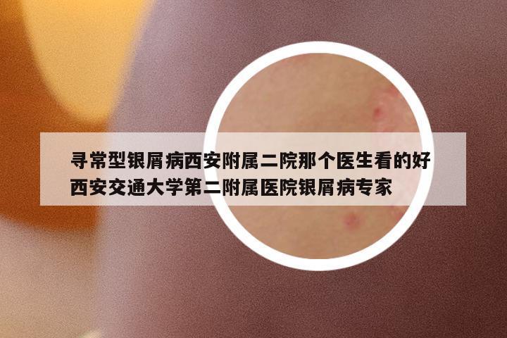 尋常型銀屑病西安附屬二院那個(gè)醫(yī)生看的好 西安交通大學(xué)第二附屬醫(yī)院銀屑病專(zhuān)家