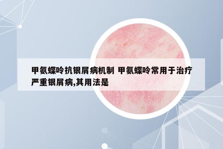 甲氨蝶呤抗銀屑病機(jī)制 甲氨蝶呤常用于治療嚴(yán)重銀屑病,其用法是