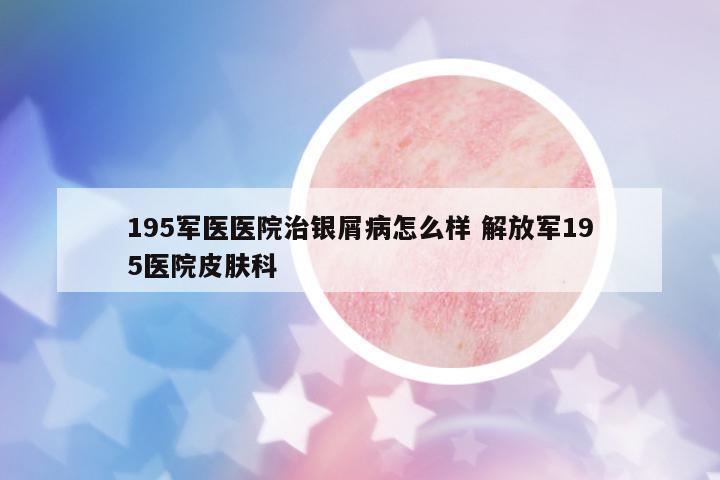 195軍醫(yī)醫(yī)院治銀屑病怎么樣 解放軍195醫(yī)院皮膚科