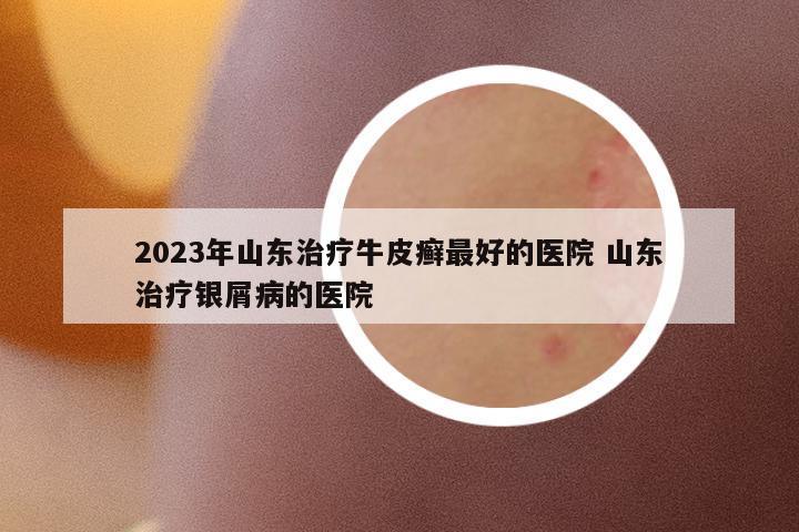 2023年山東治療牛皮癬最好的醫(yī)院 山東治療銀屑病的醫(yī)院