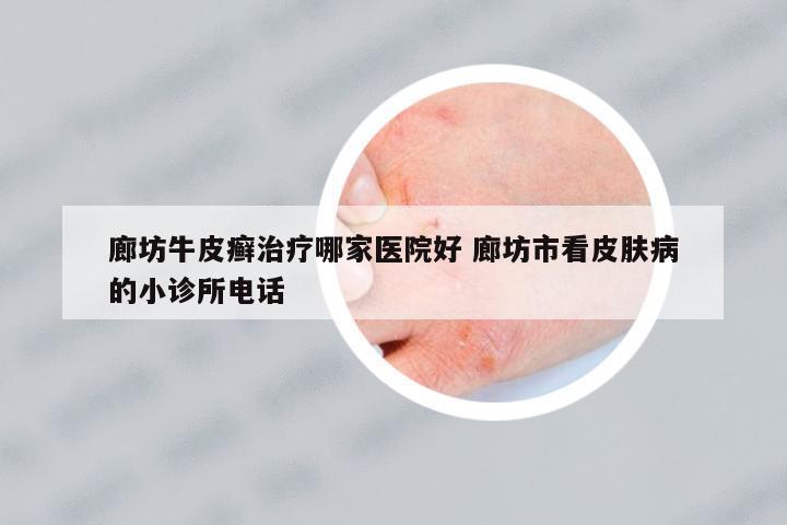 廊坊牛皮癬治療哪家醫(yī)院好 廊坊市看皮膚病的小診所電話