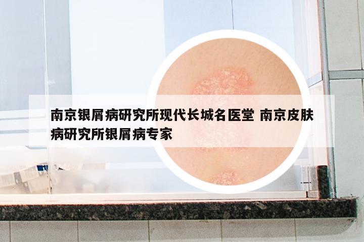 南京銀屑病研究所現(xiàn)代長城名醫(yī)堂 南京皮膚病研究所銀屑病專家
