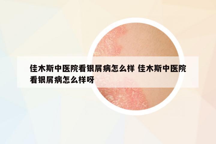佳木斯中醫(yī)院看銀屑病怎么樣 佳木斯中醫(yī)院看銀屑病怎么樣呀