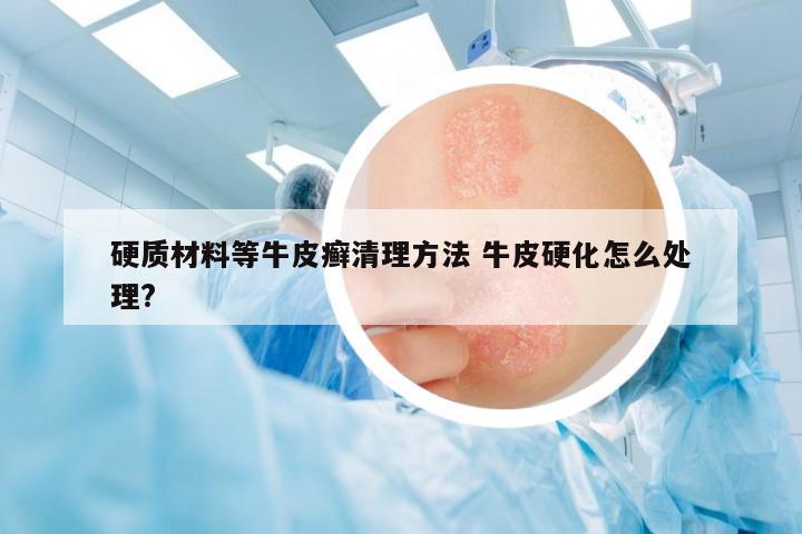 硬質(zhì)材料等牛皮癬清理方法 牛皮硬化怎么處理?