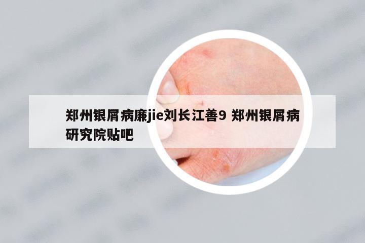 鄭州銀屑病廉jie劉長(zhǎng)江善9 鄭州銀屑病研究院貼吧