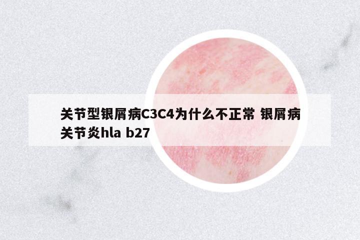 關(guān)節(jié)型銀屑病C3C4為什么不正常 銀屑病關(guān)節(jié)炎hla b27