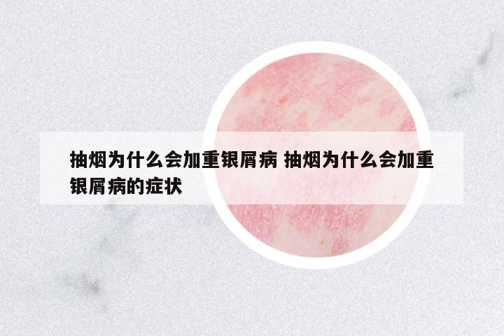 抽煙為什么會加重銀屑病 抽煙為什么會加重銀屑病的癥狀