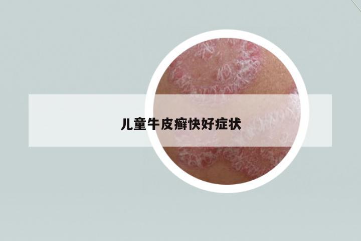 兒童牛皮癬快好癥狀