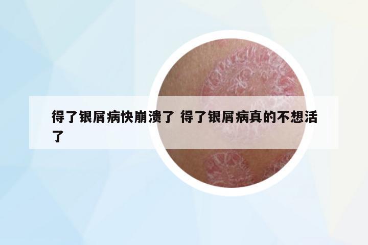 得了銀屑病快崩潰了 得了銀屑病真的不想活了