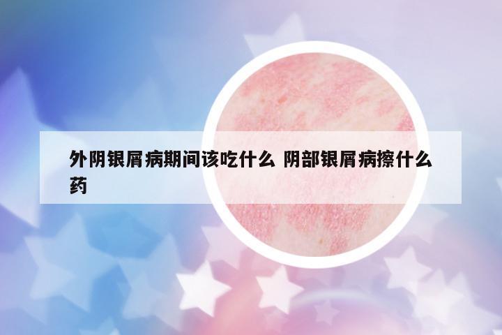 外陰銀屑病期間該吃什么 陰部銀屑病擦什么藥