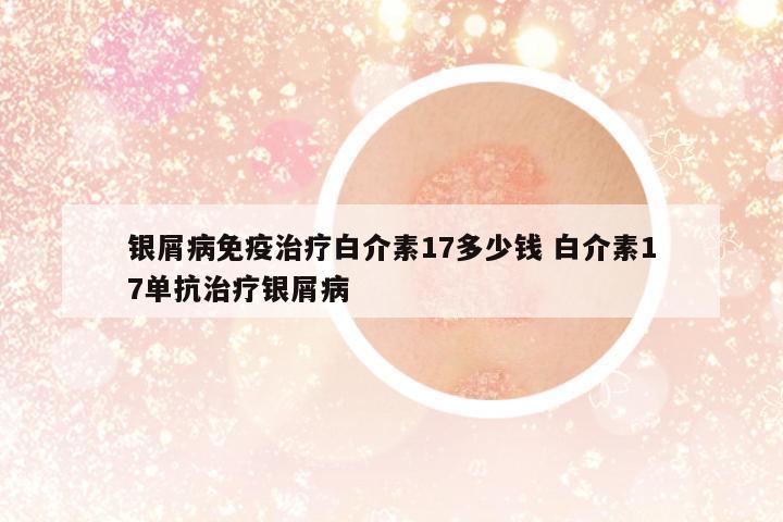 銀屑病免疫治療白介素17多少錢 白介素17單抗治療銀屑病