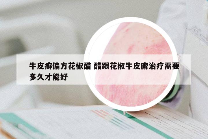 牛皮癬偏方花椒醋 醋跟花椒牛皮廨治療需要多久才能好