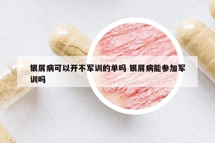 銀屑病可以開不軍訓(xùn)的單嗎 銀屑病能參加軍訓(xùn)嗎