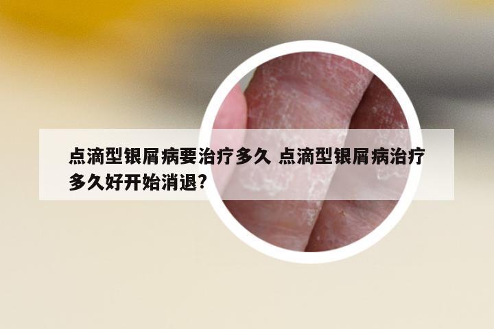 點滴型銀屑病要治療多久 點滴型銀屑病治療多久好開始消退?