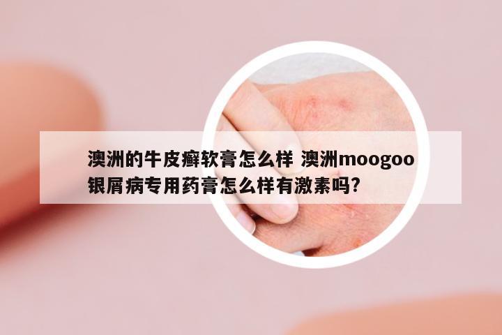 澳洲的牛皮癬軟膏怎么樣 澳洲moogoo銀屑病專用藥膏怎么樣有激素嗎?