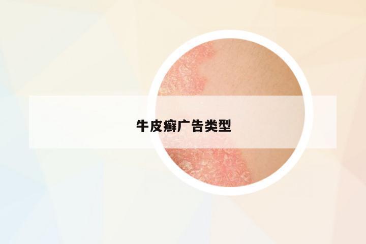 牛皮癬廣告類型