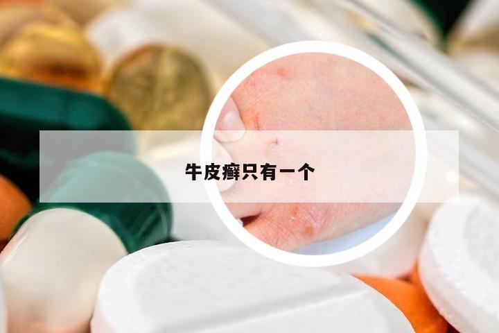 牛皮癬只有一個